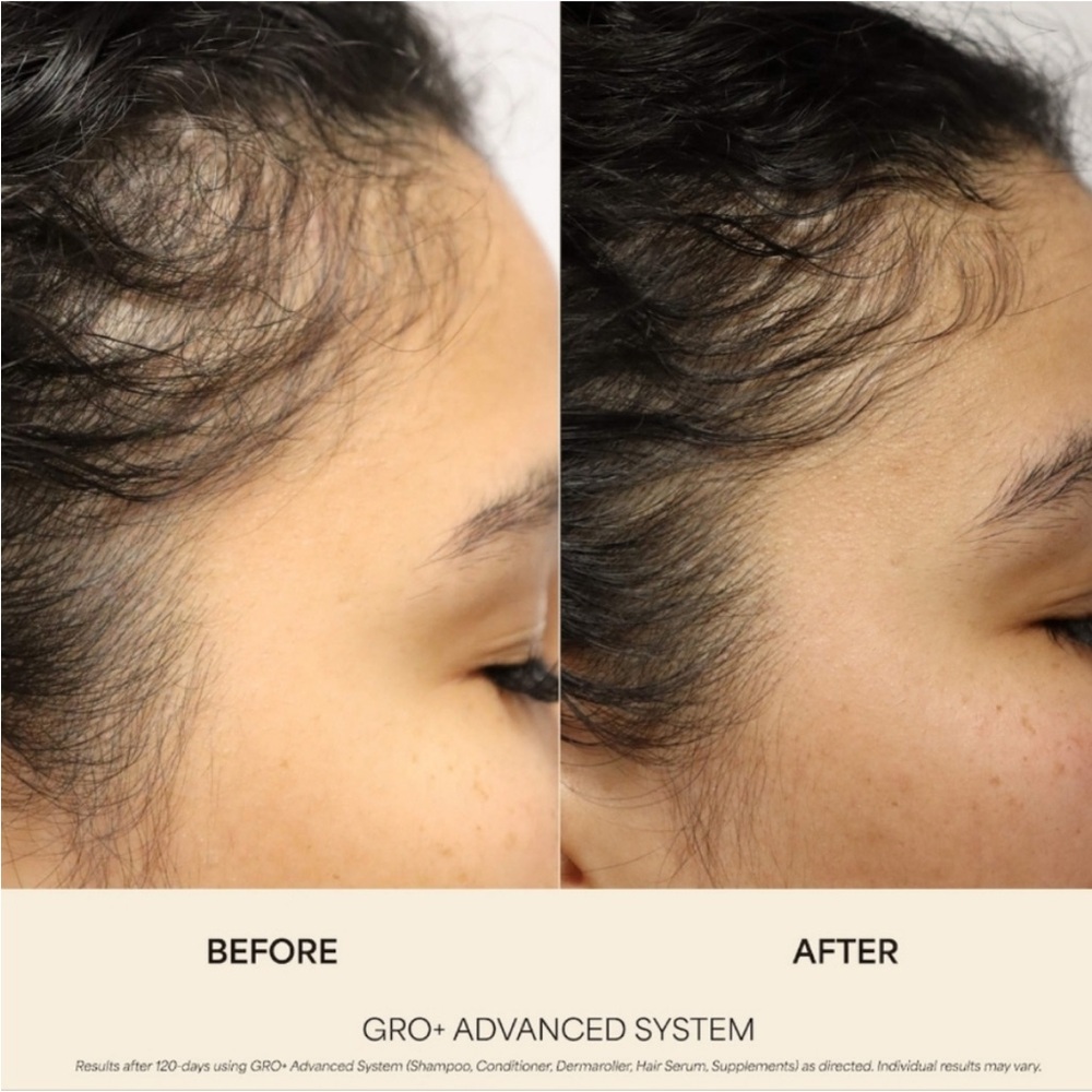 NIB VEGAMOUR GRO ADVANCED HAIR GROWTH SYSTEM - Picture 3 of 10